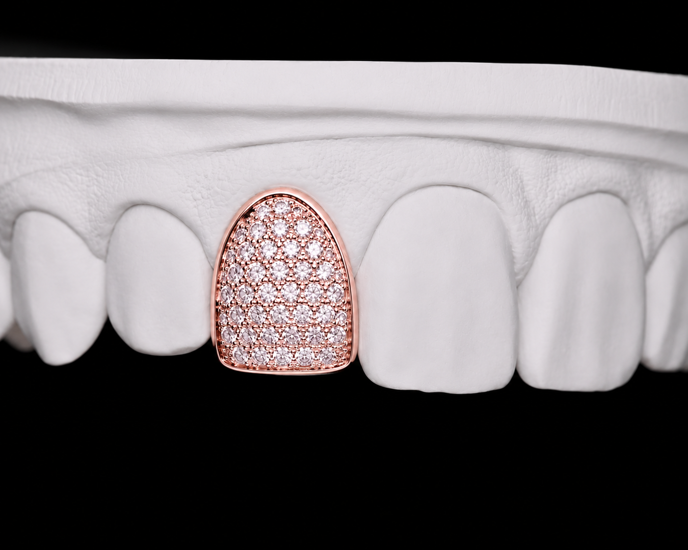Single Cap Grillz — Iced Out — Rose Gold