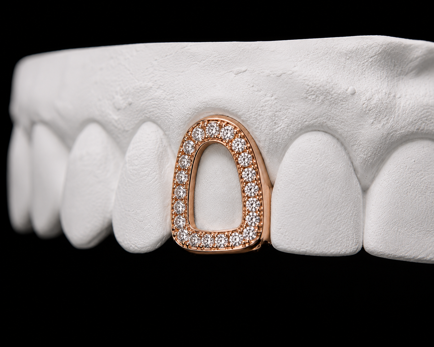 Full Set Grillz — Iced Window — Rose Gold