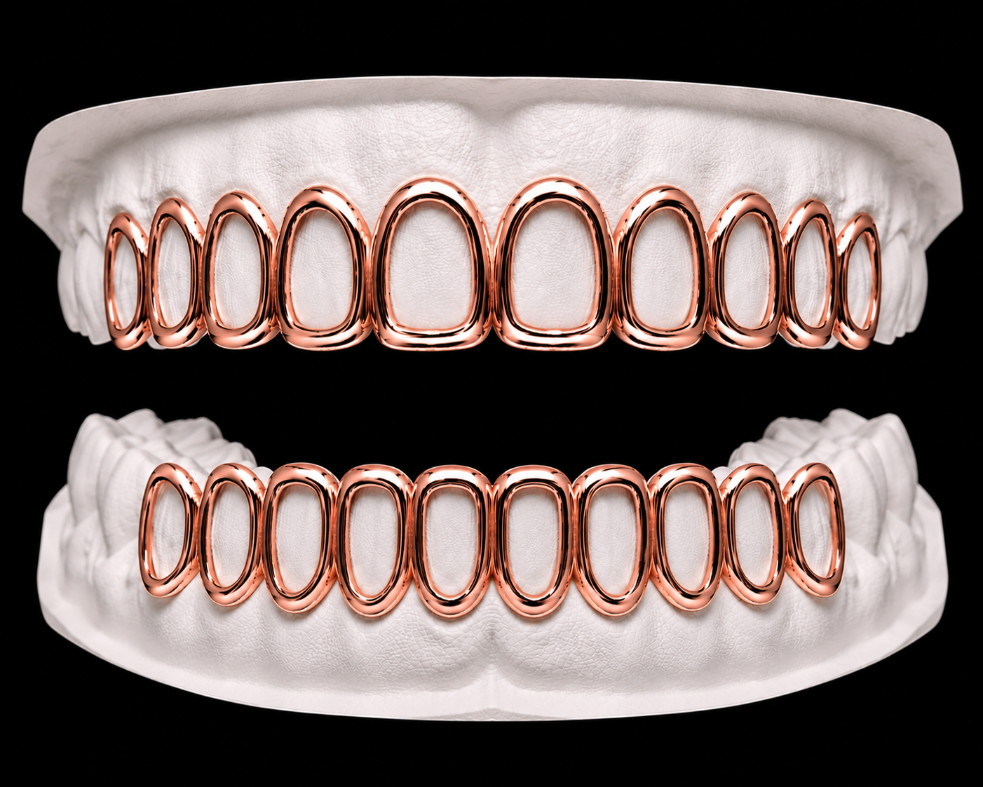 Full Set Grillz — Window — Rose Gold