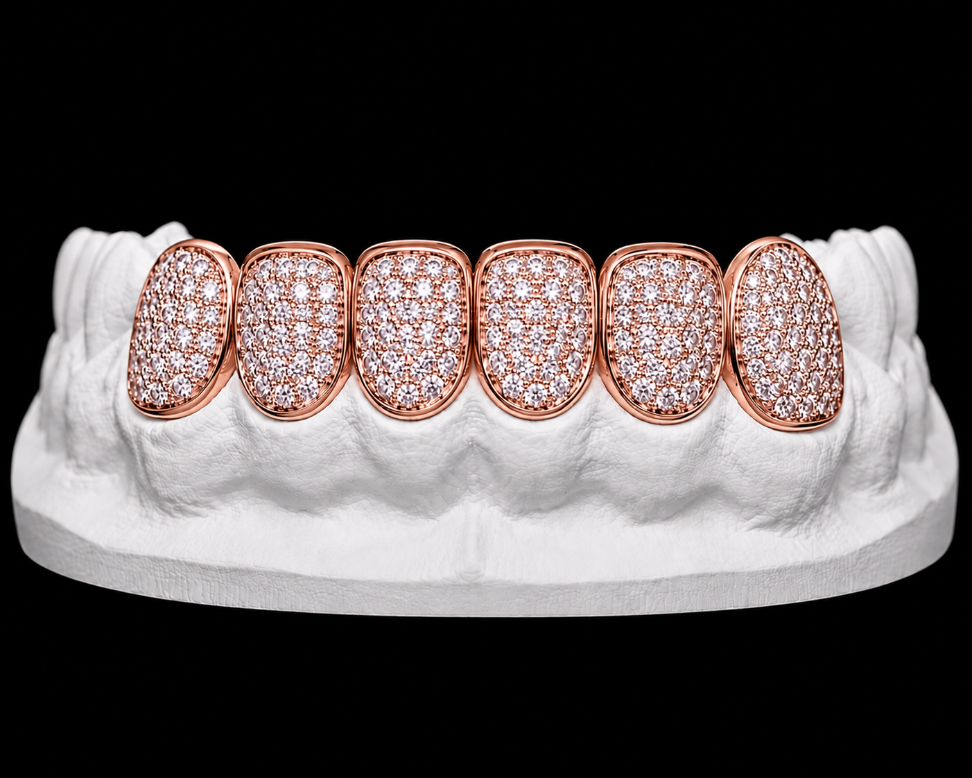 Bottom 6 Grillz — Iced Out — Rose Gold