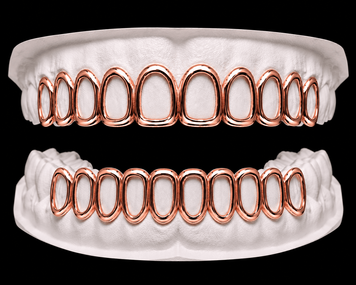 Full Set Grillz — Window - 19 Eleven Jewellers