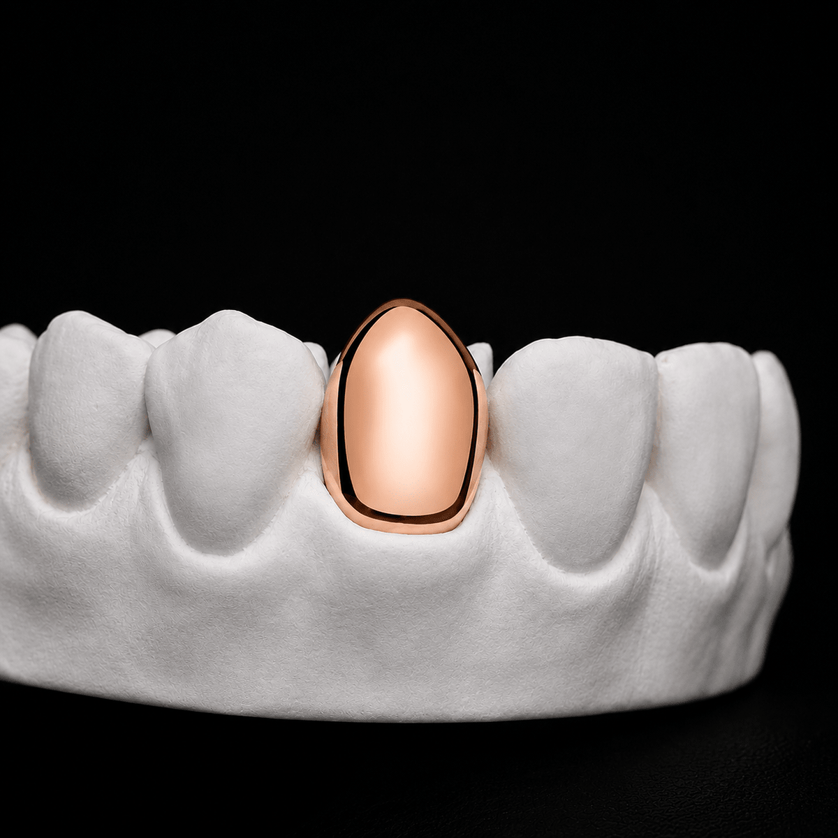 Single Cap Grillz — Plain Solid - 19 Eleven Jewellers
