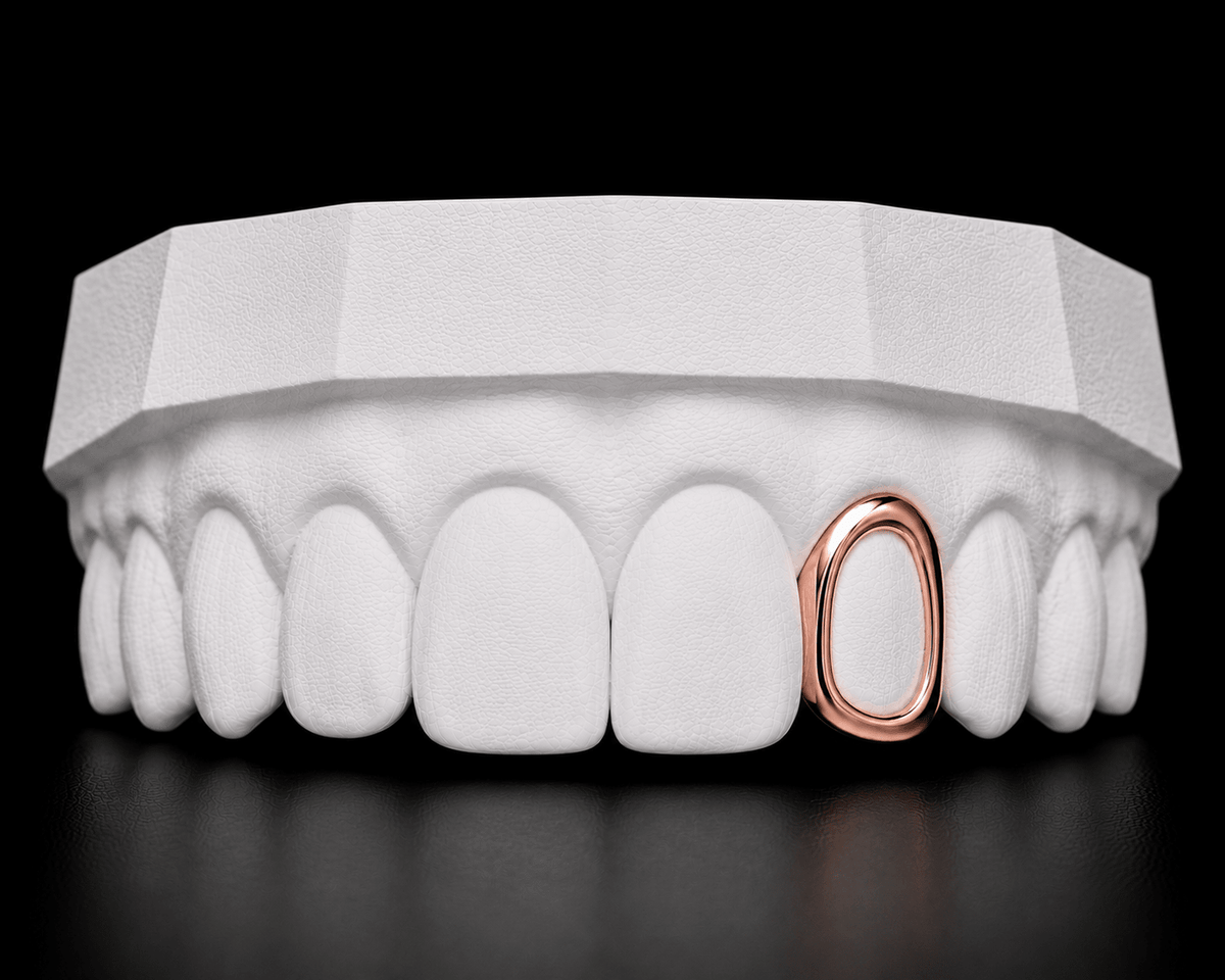 Single Cap Grillz — Window - 19 Eleven Jewellers