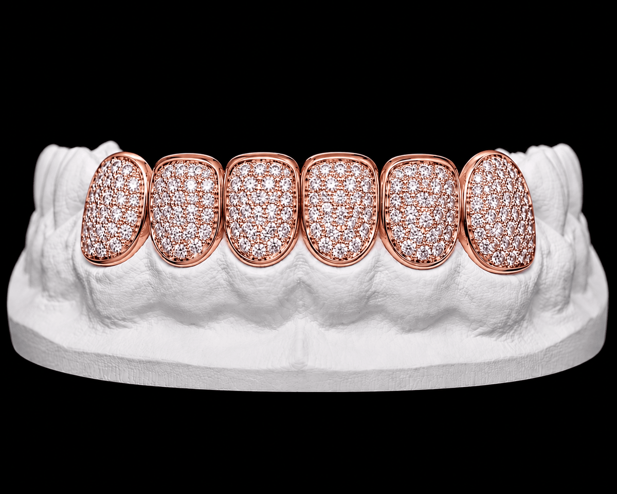 Bottom 6 Grillz — Iced Out - 19 Eleven Jewellers