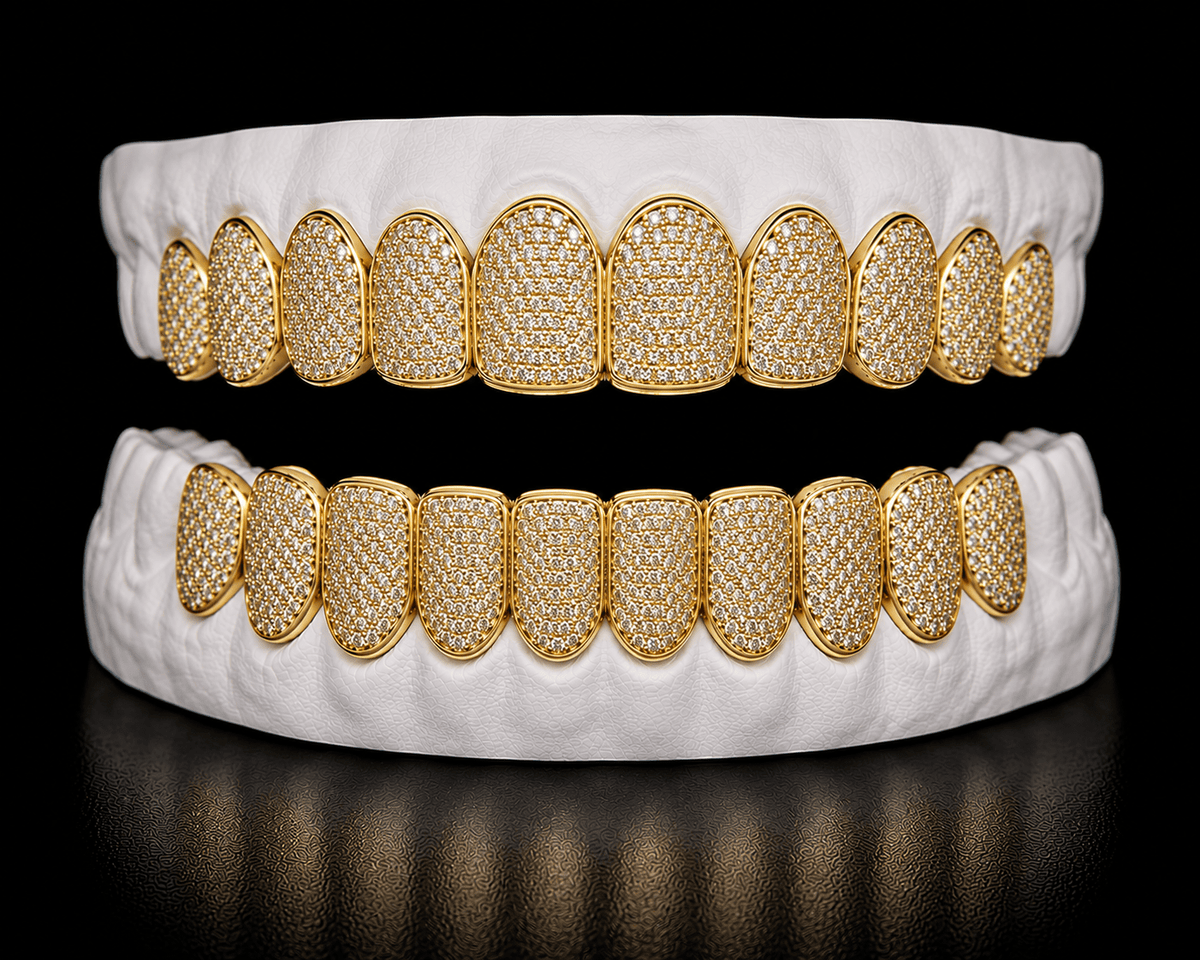 Full Set Grillz — Iced Out - 19 Eleven Jewellers