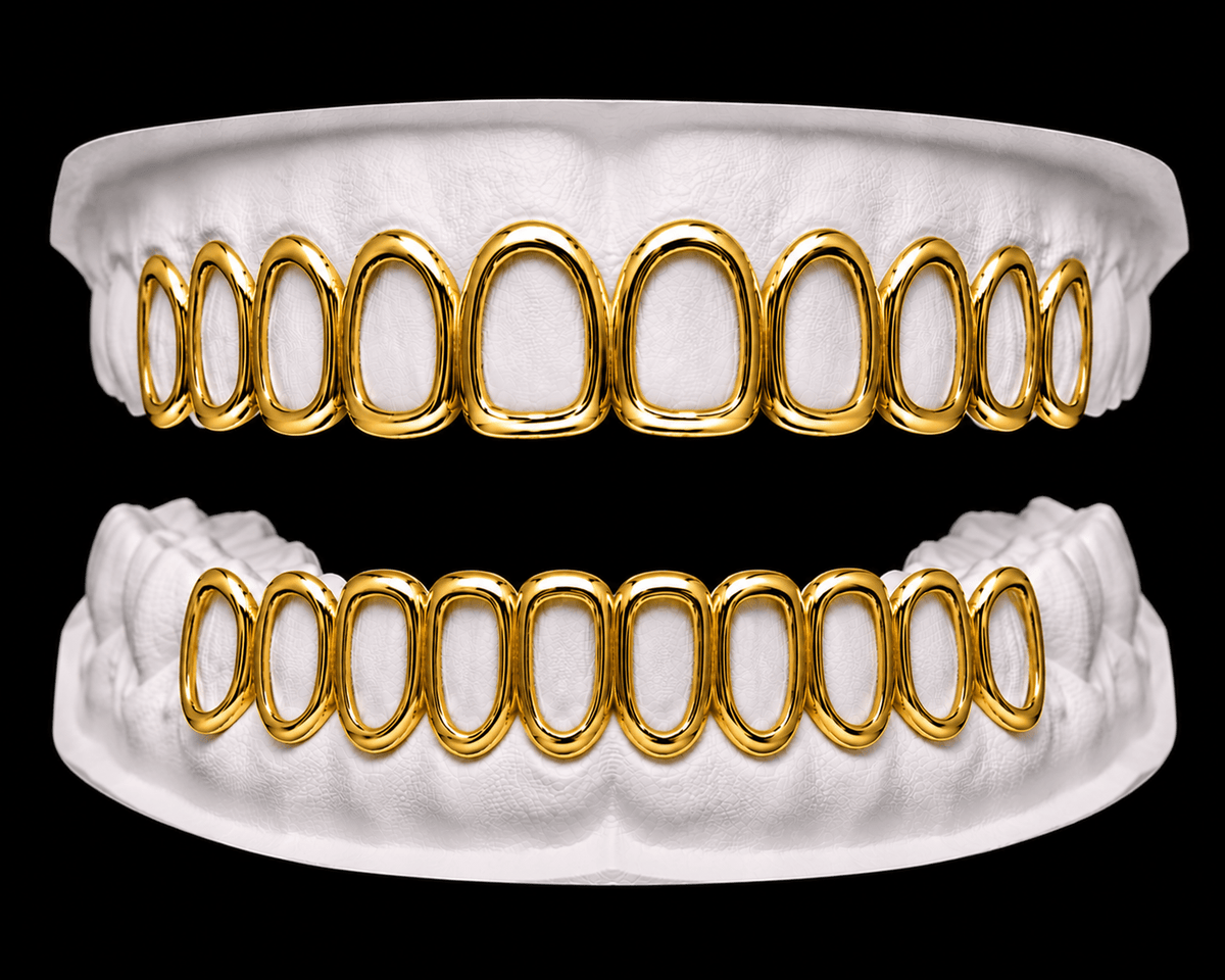 Full Set Grillz — Iced Window - 19 Eleven Jewellers
