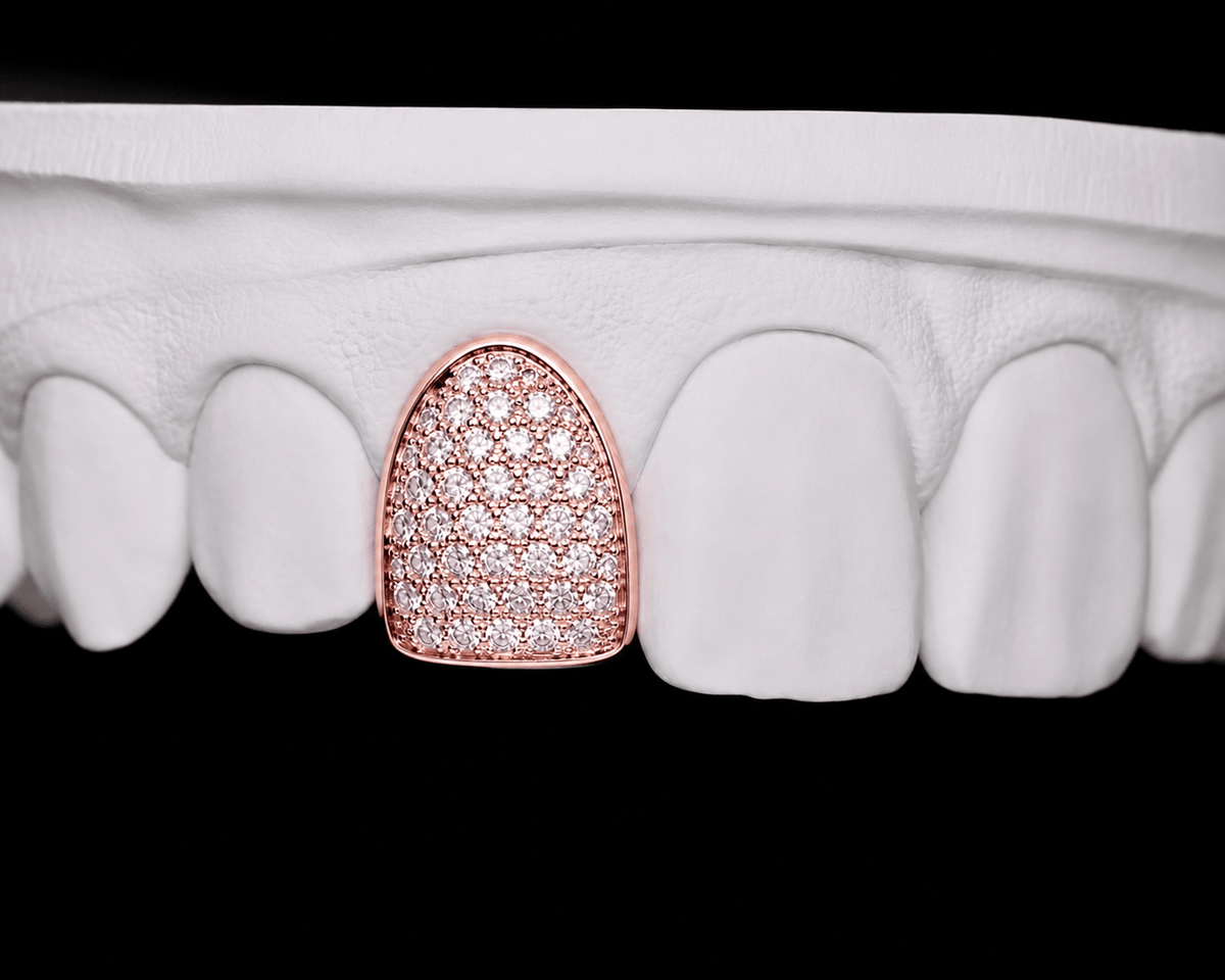 Single Cap Grillz — Iced Out - 19 Eleven Jewellers