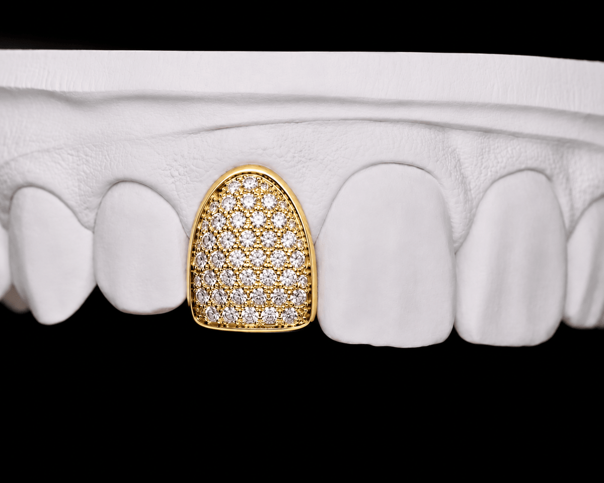 Single Cap Grillz — Iced Out - 19 Eleven Jewellers