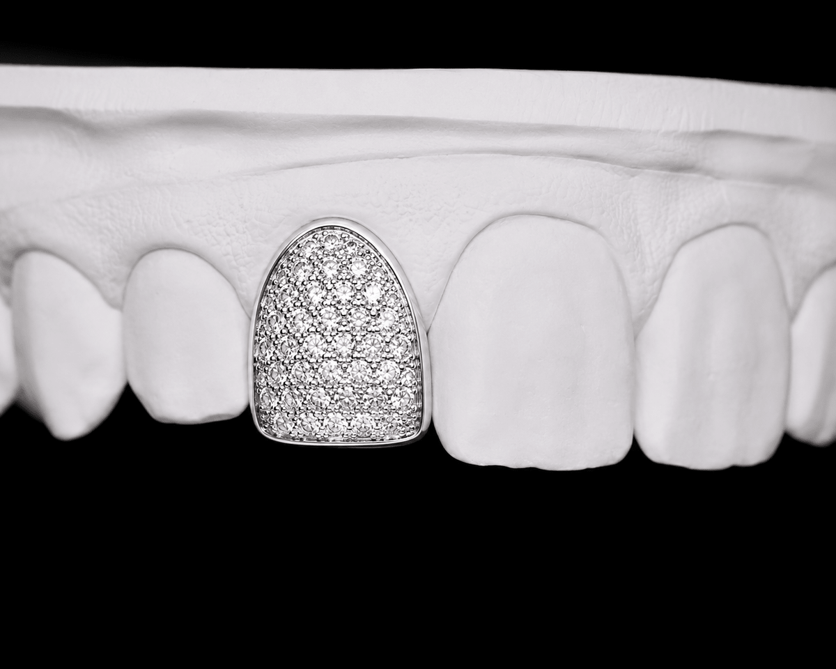 Single Cap Grillz — Iced Out - 19 Eleven Jewellers