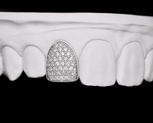 Single Cap Grillz — Iced Out - 19 Eleven Jewellers