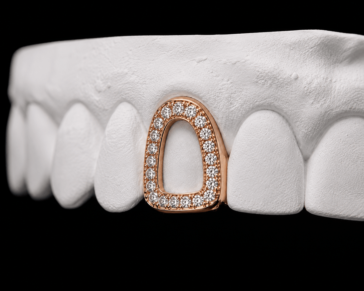 Single Cap Grillz — Iced Window - 19 Eleven Jewellers