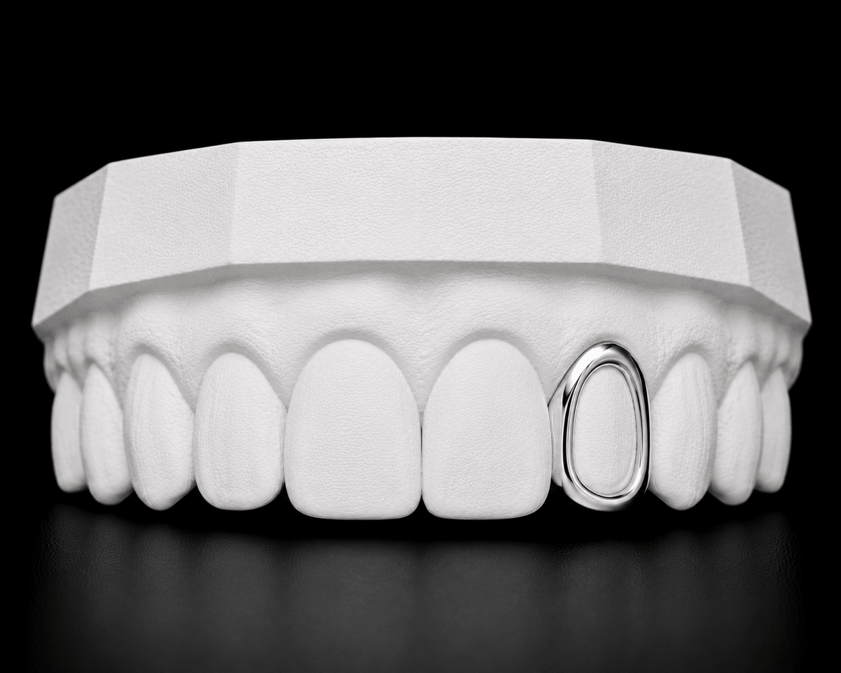 Single Cap Grillz — Window - 19 Eleven Jewellers