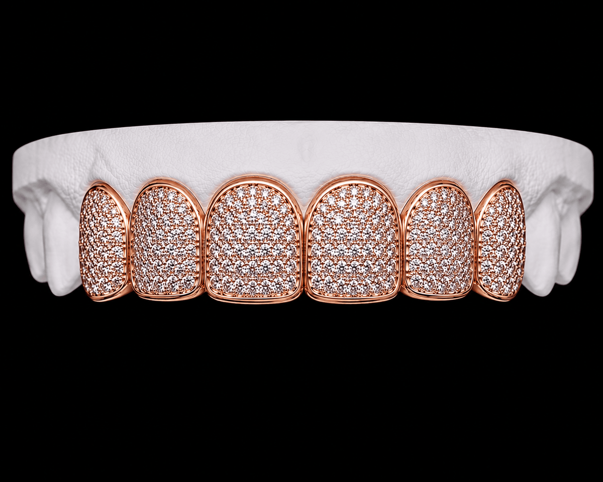 Top 6 Grillz — Iced Out - 19 Eleven Jewellers